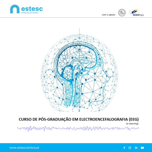 Jornal Campeão: ESTeSC-IPC lança 2.ª edição de pós-graduação em Electroencefalografia
